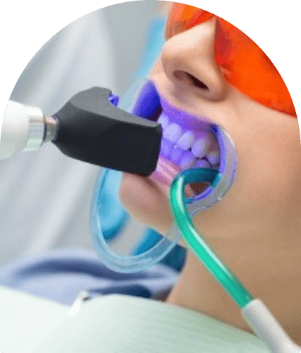 Clareamento dental em Salvador