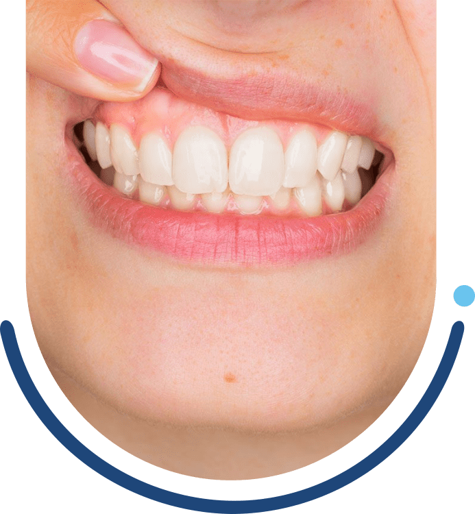 Periodontia em Salvador